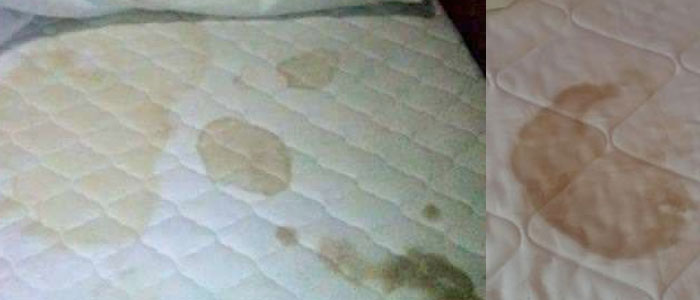 Removing dry blood stains from mattress